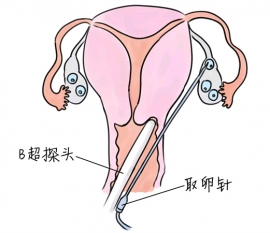 幼儿学画画，绍兴捐卵宝宝学画画，学画画的好处，如何学画画