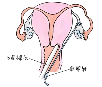 幼儿学画画，绍兴捐卵宝宝学画画，学画画的好处，如何学画画